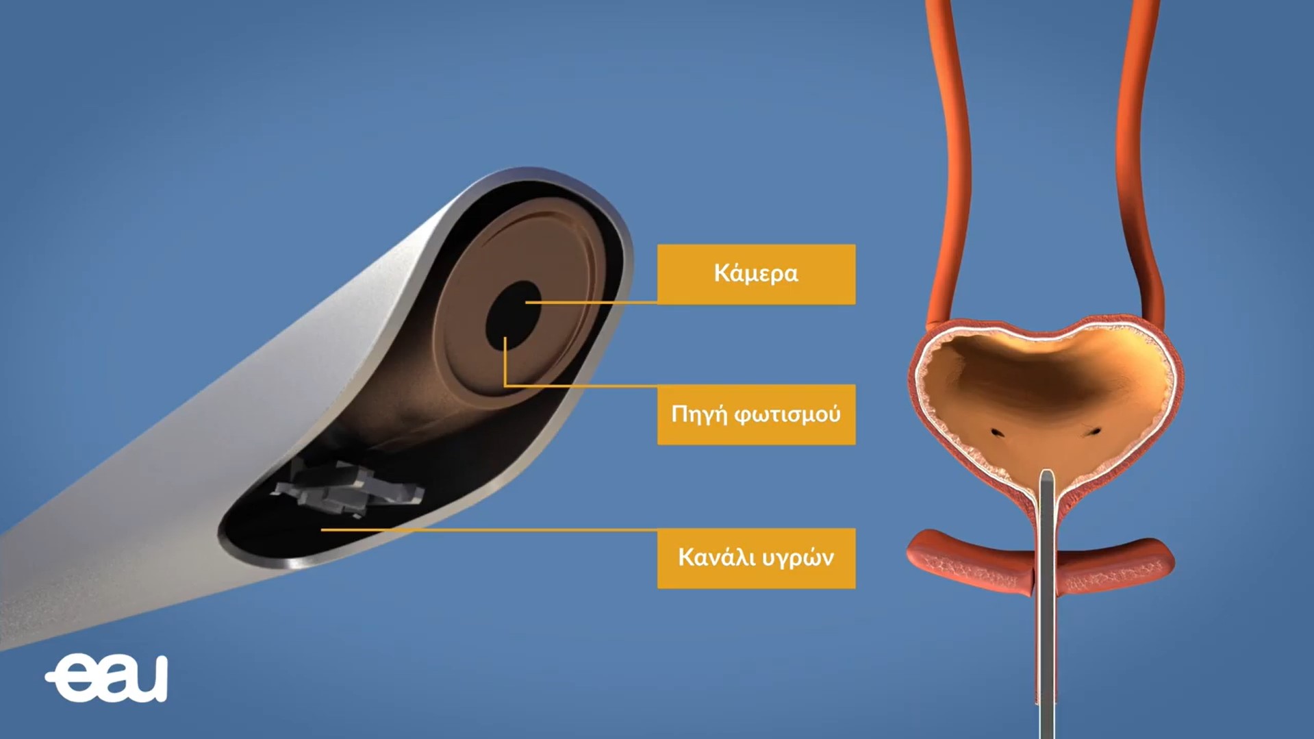 Κυστεοσκόπηση