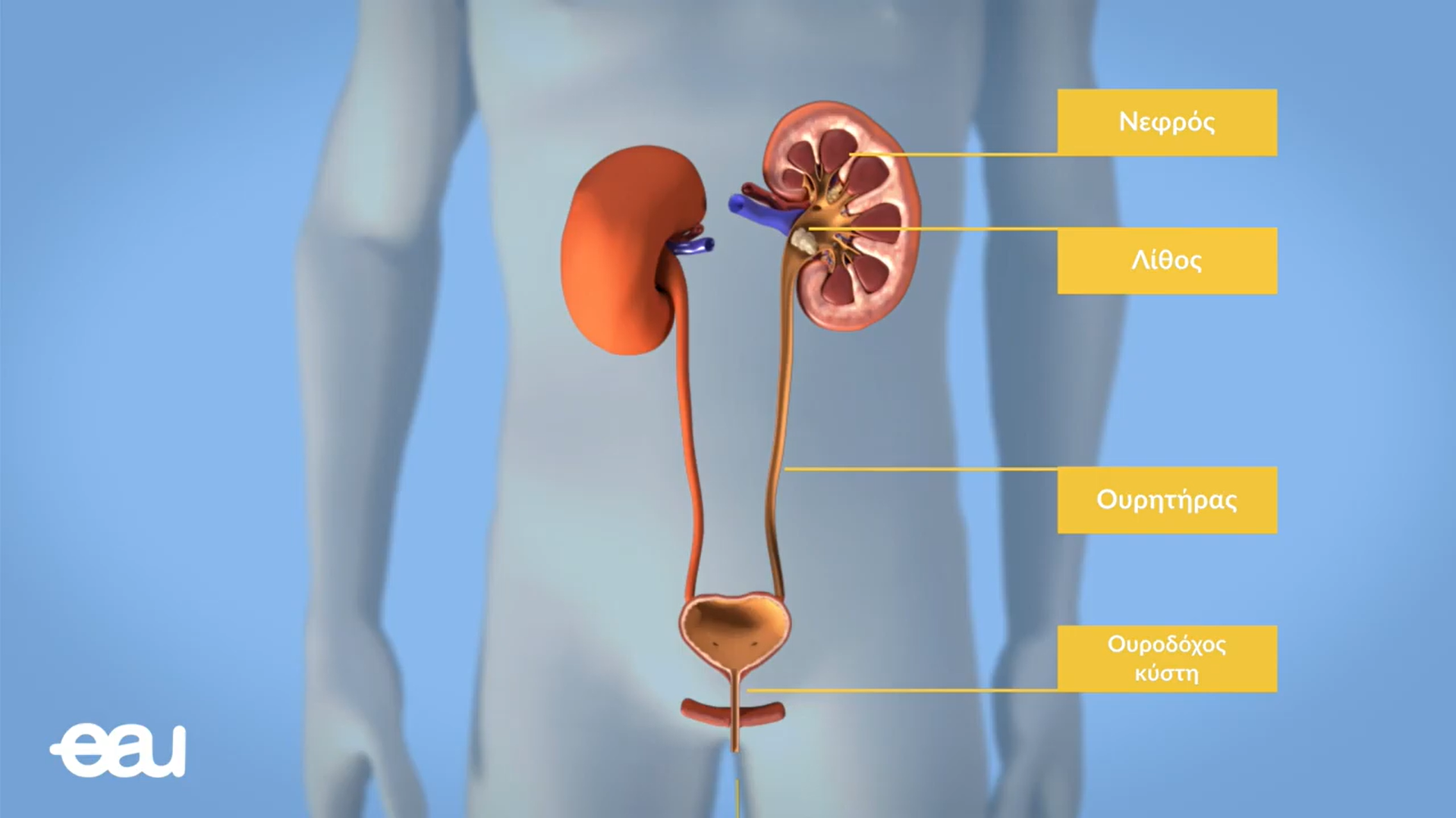Διαδερμική Λιθοθρυψία